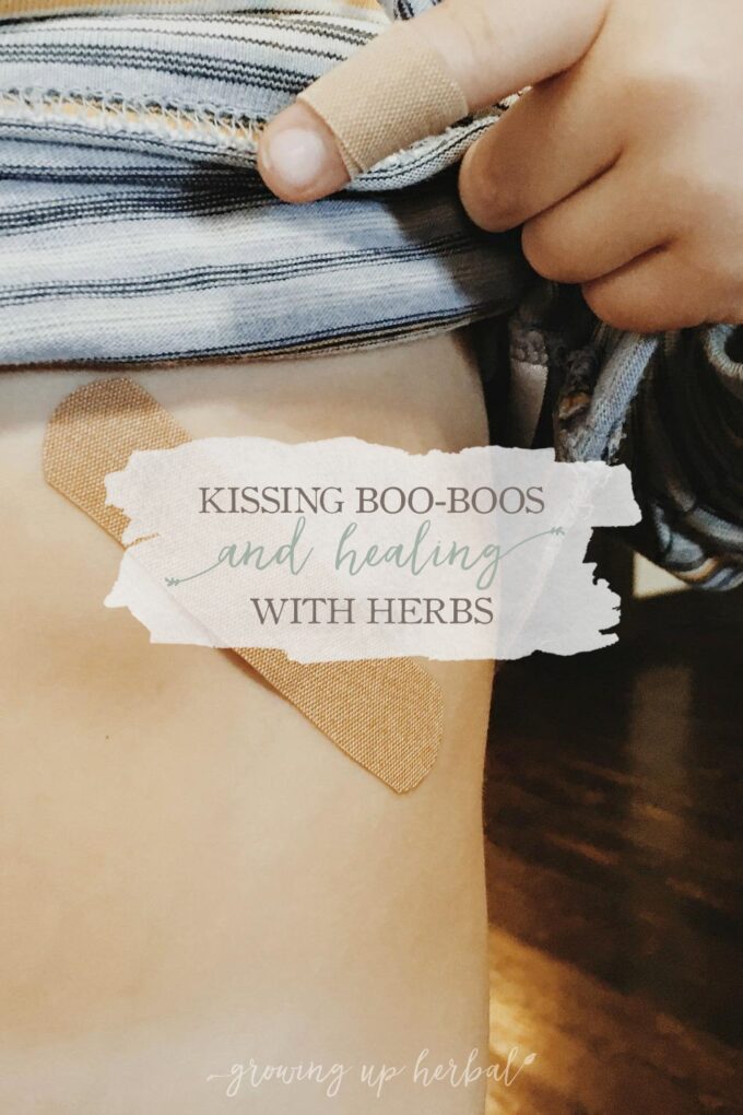 Kissing Boo-Boos And Healing With Herbs | Growing Up Herbal | Herbs can be an amazing addition to mama's kisses when it comes to managing your child's boo-boos!