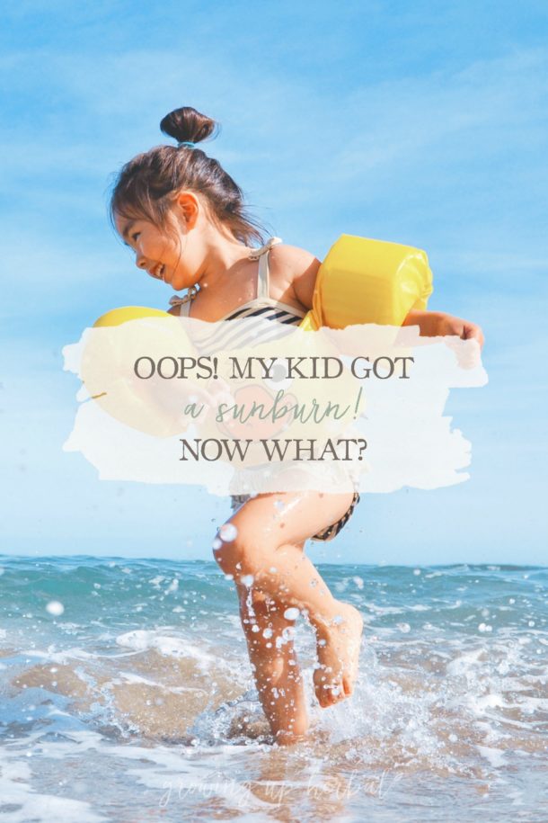 what-to-do-when-your-child-gets-sunburned