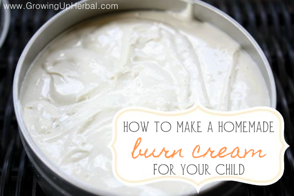 How To Make A Homemade Burn Cream For Your Child