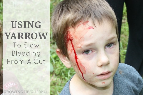Using Yarrow To Slow Bleeding From A Cut | Growing Up Herbal | A story of a wound and how yarrow helped stop its bleeding.
