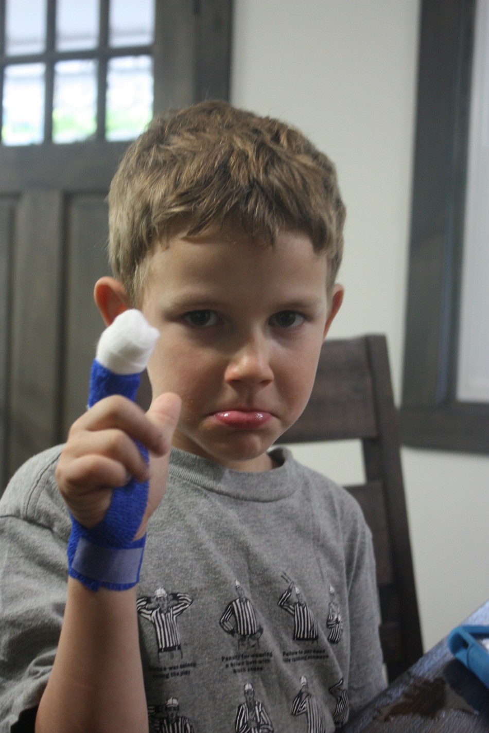 Mangled Fingers, ER Visits, And Herbal Wound Care | Growing Up Herbal | Today I'm sharing how my kiddo cut his finger off and how we're managing the wound with herbs.