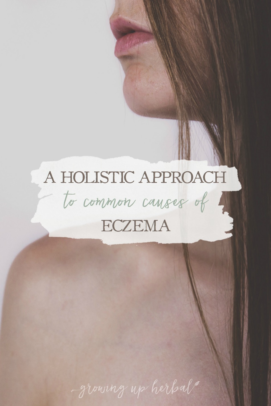 A Holistic Approach To Common Causes of Eczema | Growing Up Herbal | Do you or someone you know suffer from eczema? Learn today how to take a holistic approach to eczema and find the healing you need!